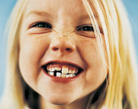 otroški zobje pri otrocih