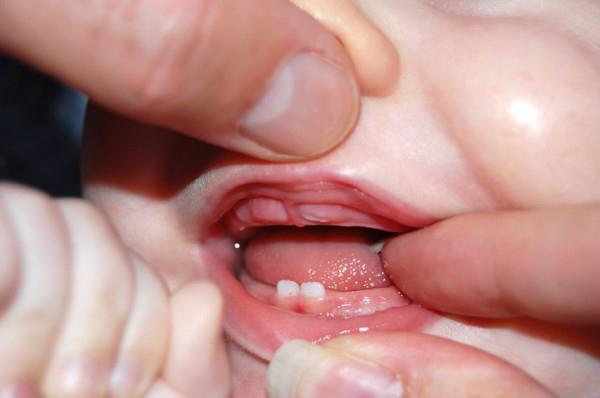 první zuby u dětí