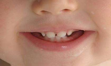 denti nella foto dei bambini