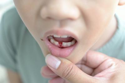 il bambino aveva un dente da latte