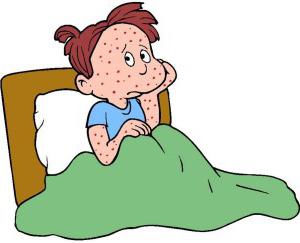Che aspetto ha la varicella nei bambini?