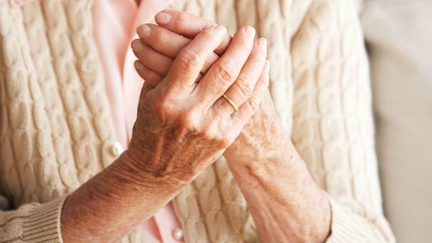 Trattamento dei rimedi popolari per l'artrite reumatoide