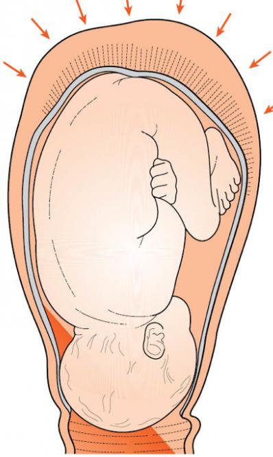 cervikální dilatace před porodem