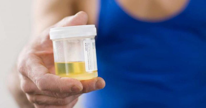 koliko urina može biti pohranjeno prije analize