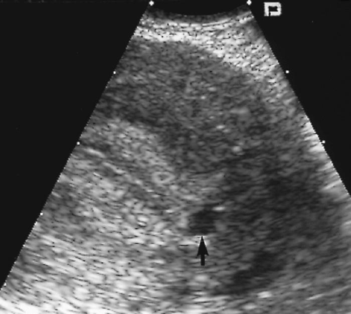 Jak długo ultradźwięki wykazują ciążę?