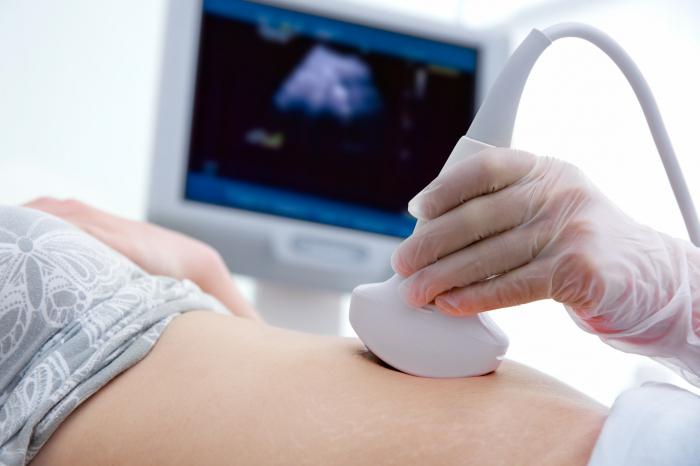 zakaj ultrazvok ne kaže nosečnosti
