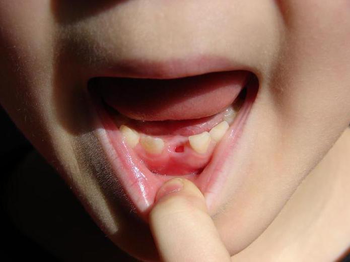 kolik dětských zubů by děti měly mít