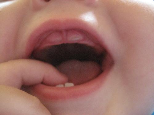 kolik měsíců jsou první řezané zuby