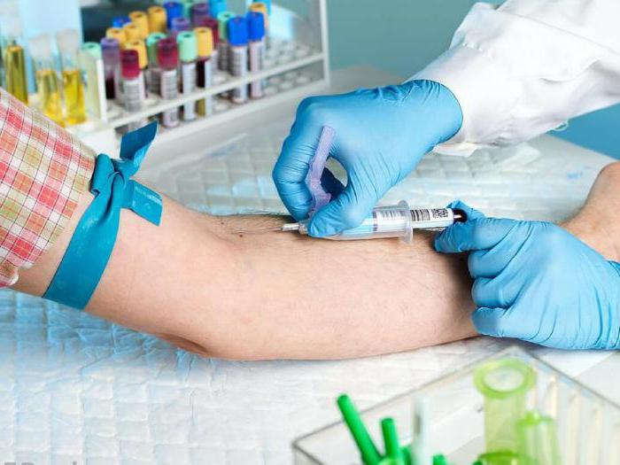 колко е кръвен тест за ХИВ