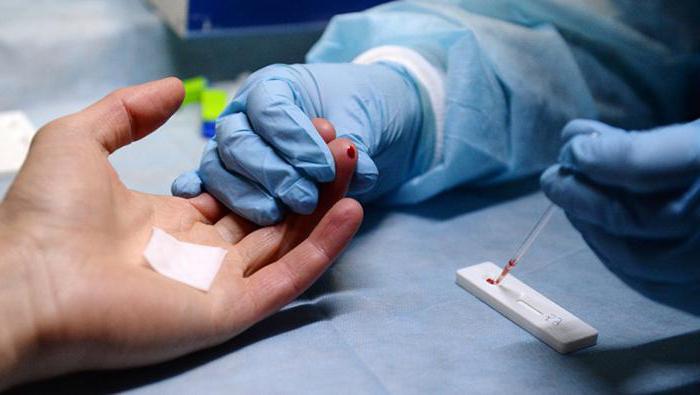 krev pro hiv, kolik dní se provádí analýza