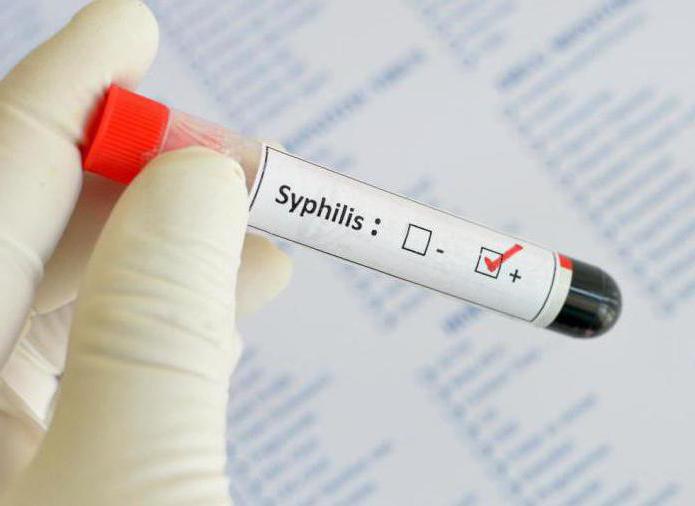 какви лекарства за лечение на сифилис