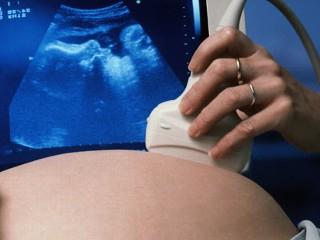 Kako pogosto lahko naredimo ultrazvok med nosečnostjo