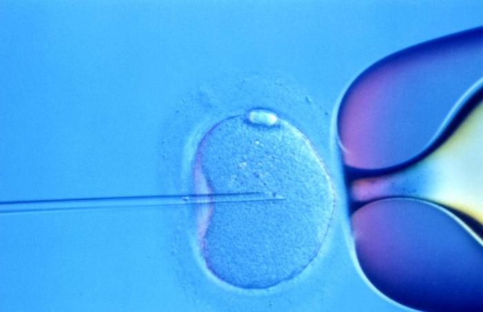 infertilità secondaria nelle donne