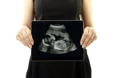 calcolare il peso fetale mediante ultrasuoni