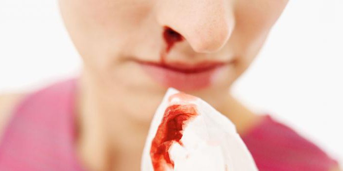 как да предизвика кръвоизлив от носа