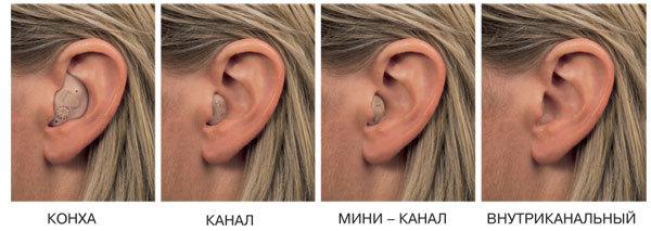 слухови апарати как да изберем цена в Москва