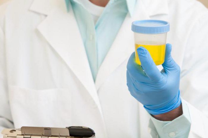 kako opraviti dnevni urinski test