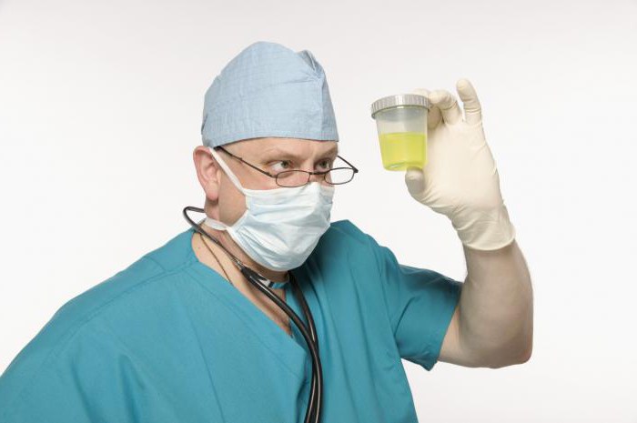 dnevni urinski test, ki se pokaže