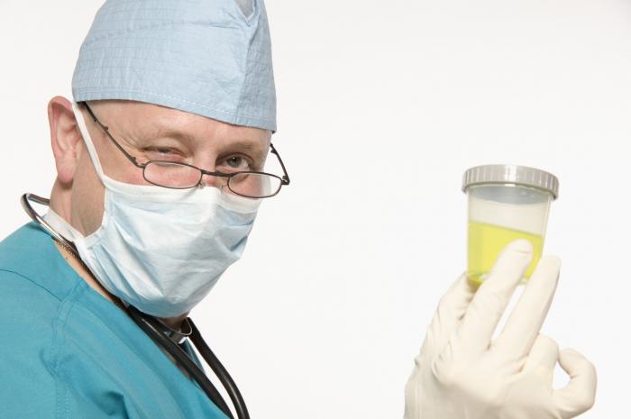 Kako skupljati urin za Nechiporenko