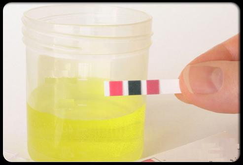 Analisi delle urine del neonato