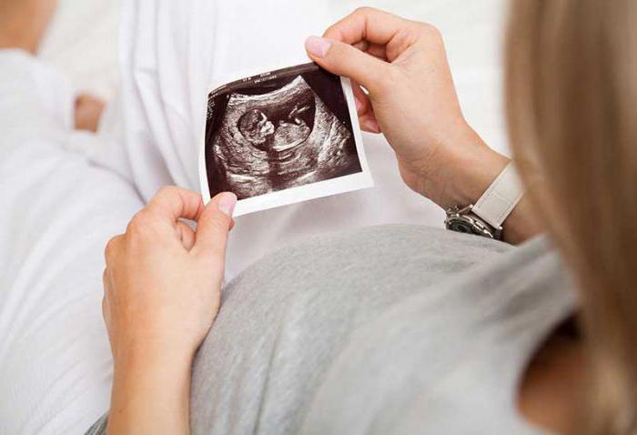 płeć dziecka z biciem serca w 12 tygodniu ciąży