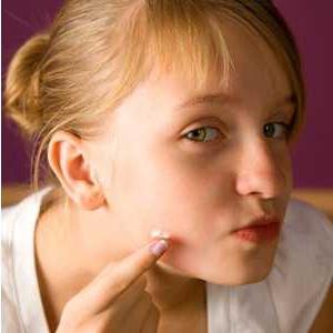 kako da biste dobili osloboditi od acne ožiljaka