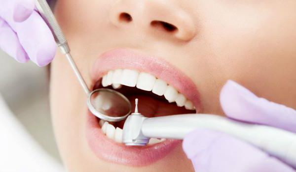 jak se zbavit zubního kazu