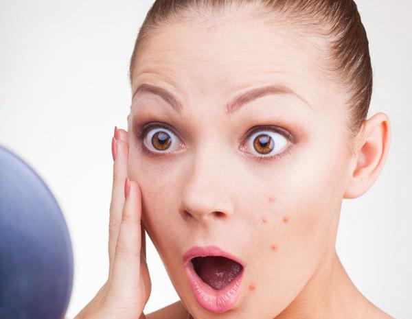 kako brzo dobiti osloboditi od acne