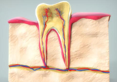 как да убиеш нерв в зъб