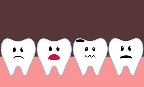 vnetje zobnega živca