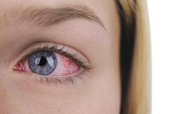 как да правим червени очи