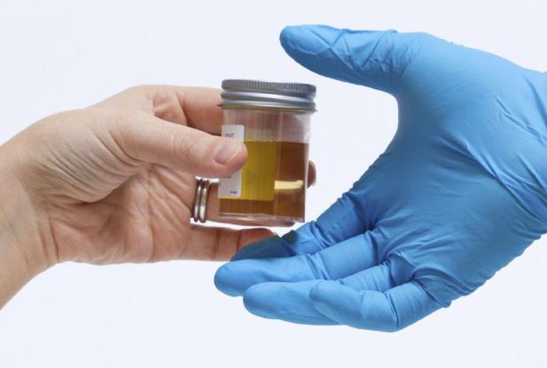 Kako opraviti test urina