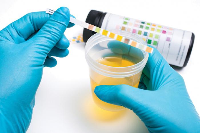 kako opraviti test urina