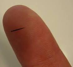 kako ukloniti komadić prsta bez boli