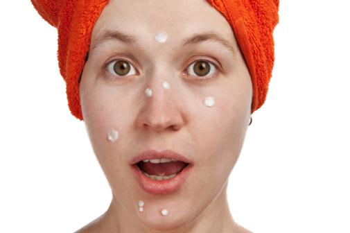 come rimuovere l'acne