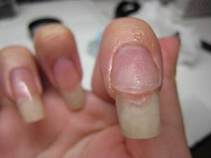 rimozione delle unghie acriliche