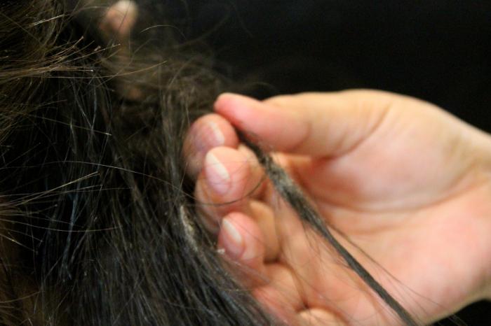 kako odstraniti samo razširljive lase