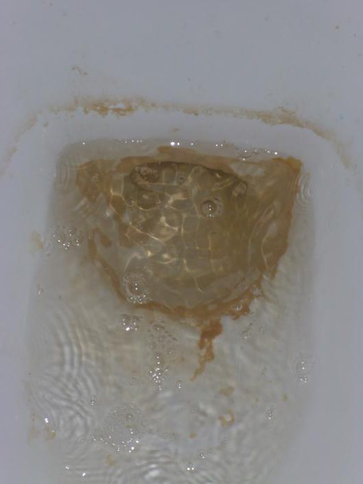 почистване на тоалетната чиния от камъка в урината