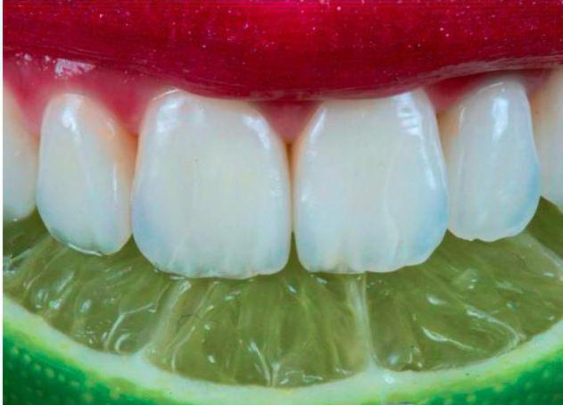 Sensibilità del dente: come rimuovere (dentifricio)