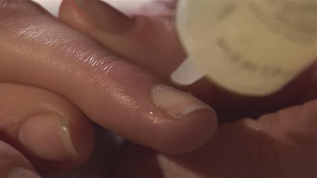 eksfoliowane przedłużone paznokcie