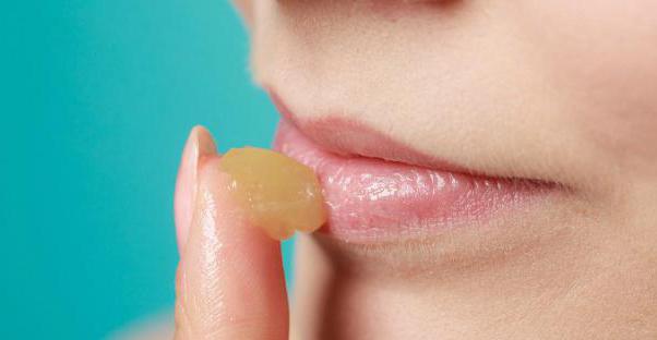 na ustnico lahko zamašite hladno zobno pasto
