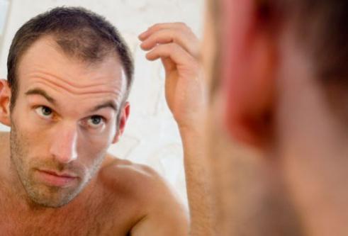 recenze na odstranění vypadávání vlasů
