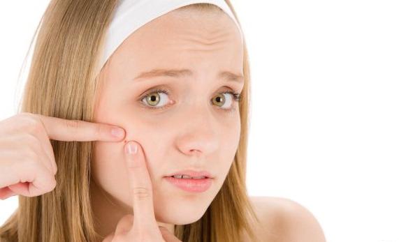 come trattare l'acne sul viso