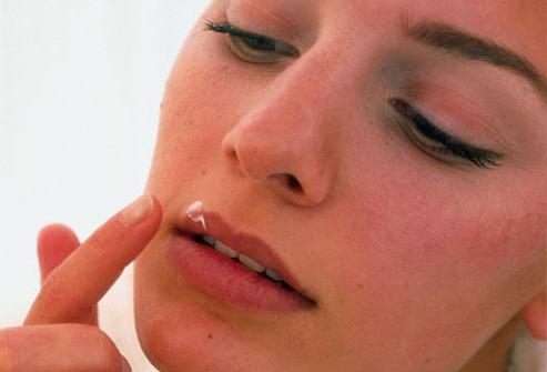 trattamento dell'herpes sulle labbra rapidamente