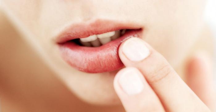 jak usunąć opryszczkę na ustach