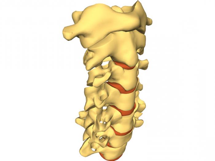 Osteochondroza szyjnego odcinka kręgosłupa