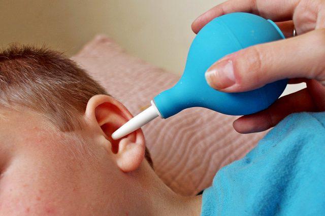 как да миете ушите си с водороден пероксид