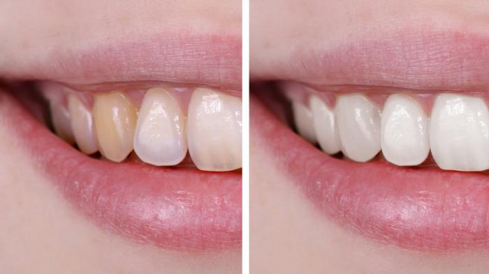 kako beliti zobe v photoshopu