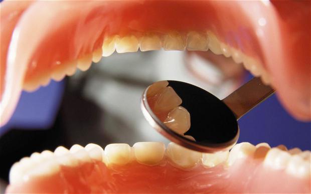 хигиенни прегледи за почистване на зъби