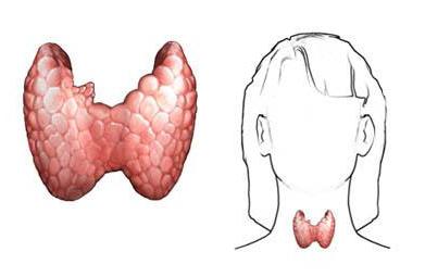 ipotiroidismo tiroideo